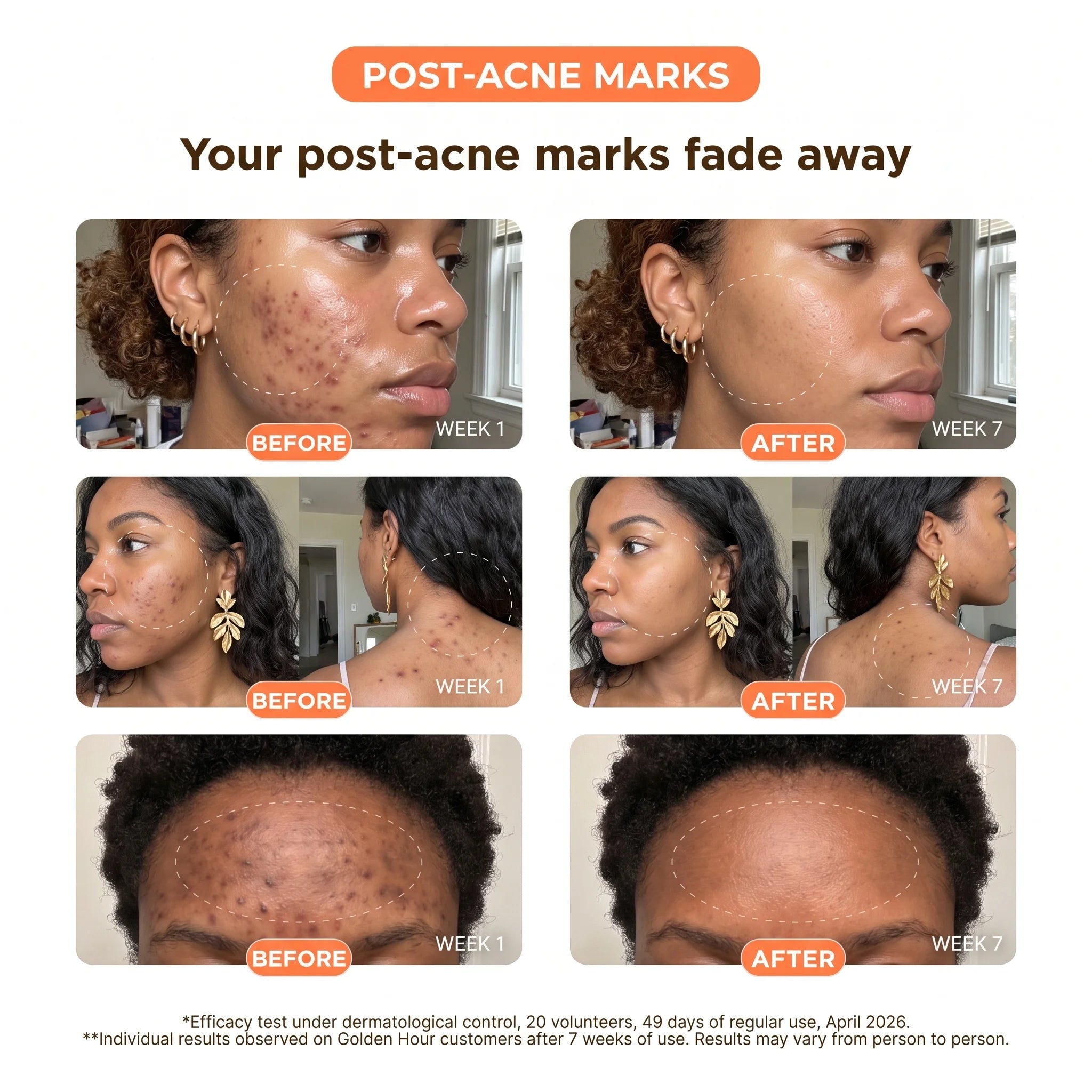 Turmeric + Vitamin C Dark Spot Pads — Face & Body