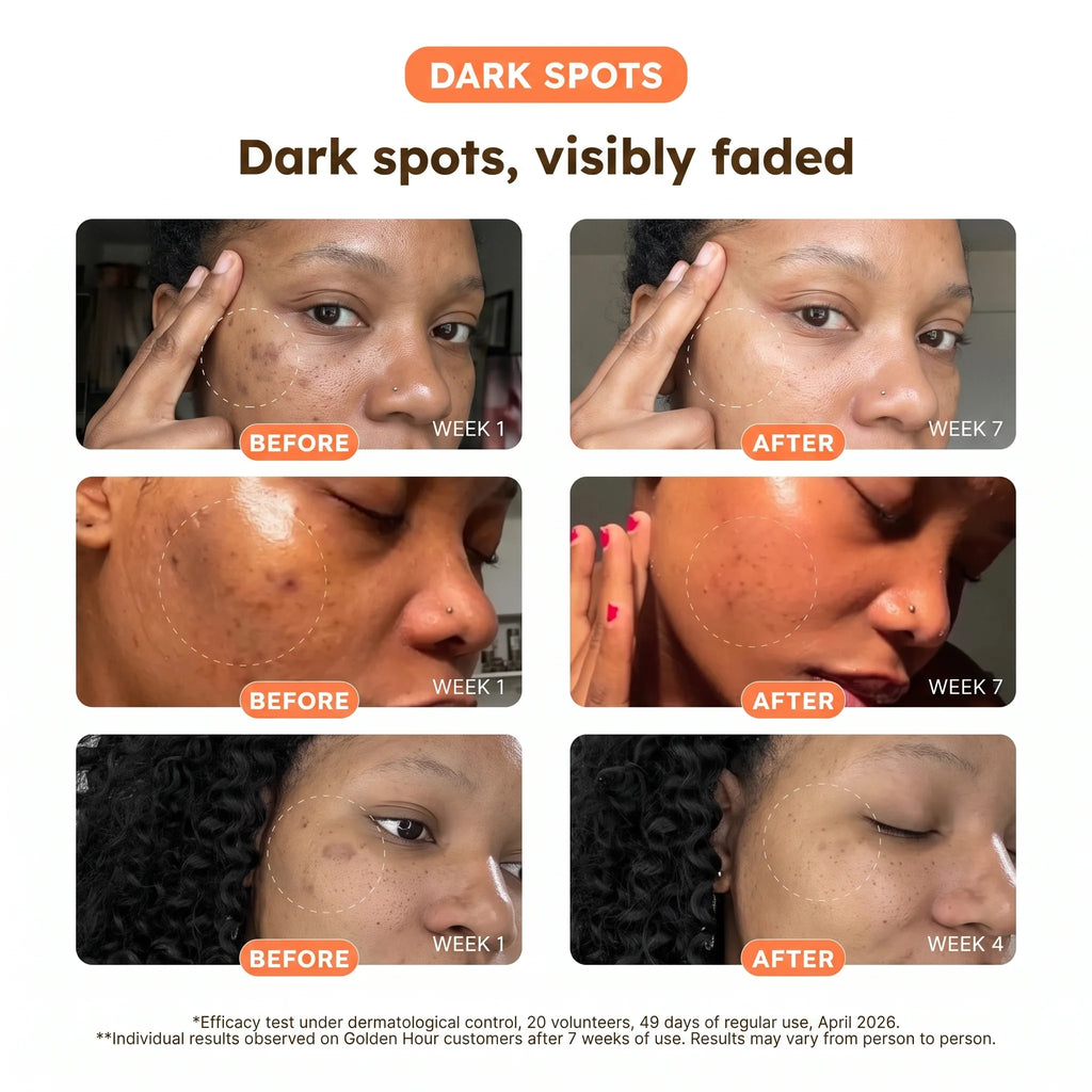 Turmeric + Vitamin C Dark Spot Pads — Face & Body