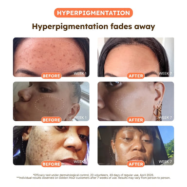 Turmeric + Vitamin C Dark Spot Pads — Face & Body