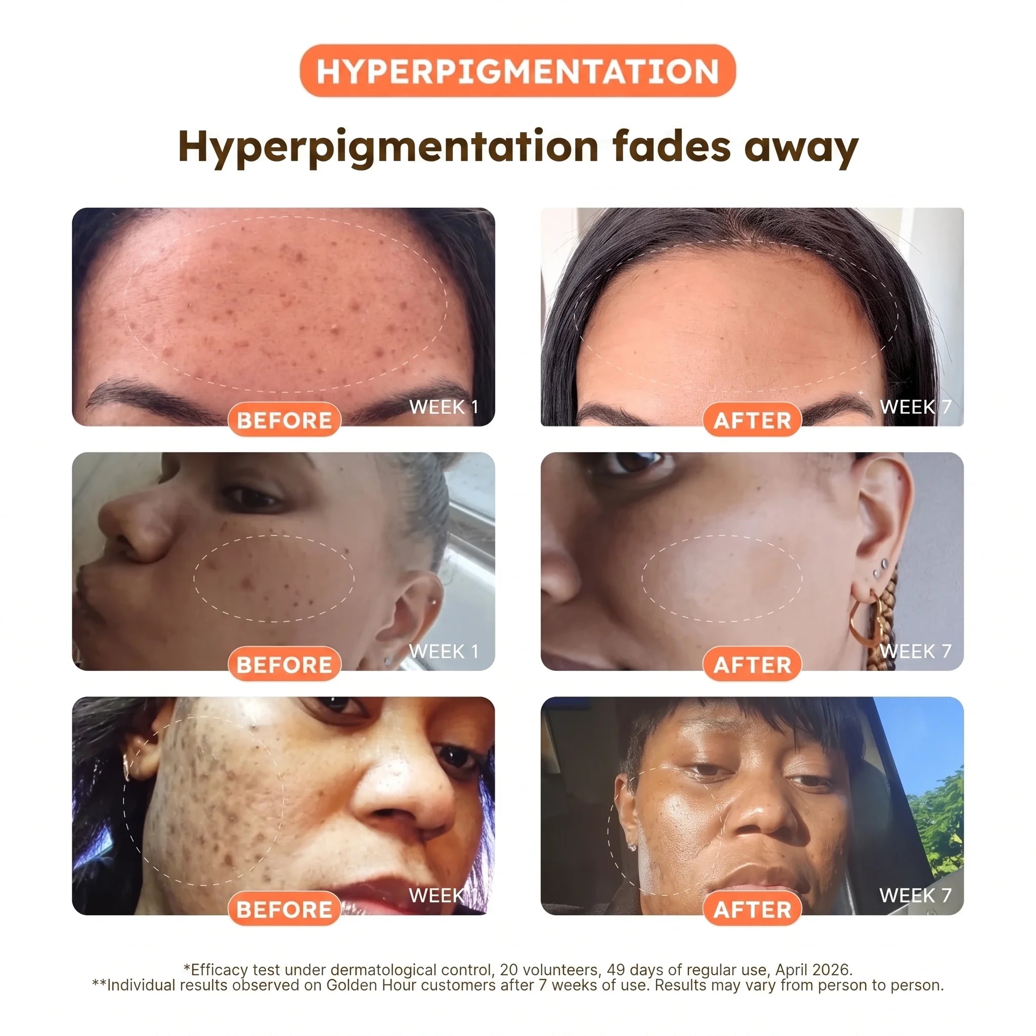 Turmeric + Vitamin C Dark Spot Pads — Face & Body